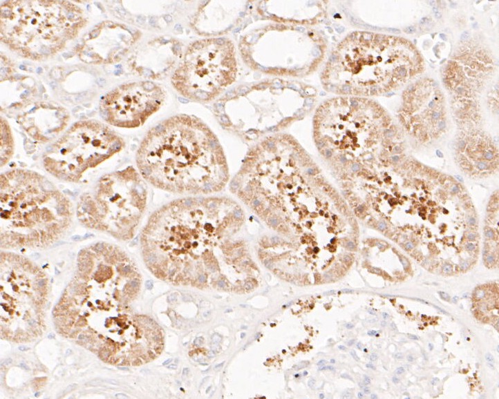 Immunohistochemical analysis of paraffin-embedded human kidney tissue using anti-FBP1 antibody. The section was pre-treated using heat mediated antigen retrieval with sodium citrate buffer (pH 6.0) for 20 minutes. The tissues were blocked in 5% BSA for 30 minutes at room temperature, washed with ddH2O and PBS, and then probed with the primary antibody (ET7110-07, 1/200)  for 30 minutes at room temperature. The detection was performed using an HRP conjugated compact polymer system. DAB was used as the chromogen. Tissues were counterstained with hematoxylin and mounted with DPX.