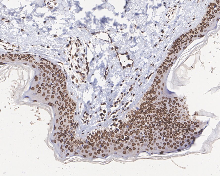 Immunohistochemical analysis of paraffin-embedded human tonsil tissue using anti-Lamin A/C antibody. The section was pre-treated using heat mediated antigen retrieval with sodium citrate buffer (pH 6.0) for 20 minutes. The tissues were blocked in 5% BSA for 30 minutes at room temperature, washed with ddH2O and PBS, and then probed with the primary antibody (ET7110-12, 1/50)  for 30 minutes at room temperature. The detection was performed using an HRP conjugated compact polymer system. DAB was used as the chromogen. Tissues were counterstained with hematoxylin and mounted with DPX.