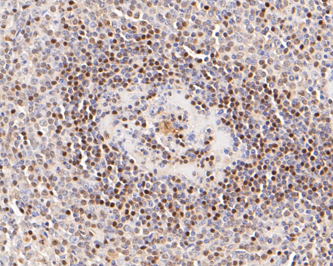 Immunohistochemical analysis of paraffin-embedded human tonsil tissue using anti-LTA4H antibody. The section was pre-treated using heat mediated antigen retrieval with sodium citrate buffer (pH 6.0) for 20 minutes. The tissues were blocked in 5% BSA for 30 minutes at room temperature, washed with ddH2O and PBS, and then probed with the primary antibody (ET7110-13, 1/50)  for 30 minutes at room temperature. The detection was performed using an HRP conjugated compact polymer system. DAB was used as the chromogen. Tissues were counterstained with hematoxylin and mounted with DPX.