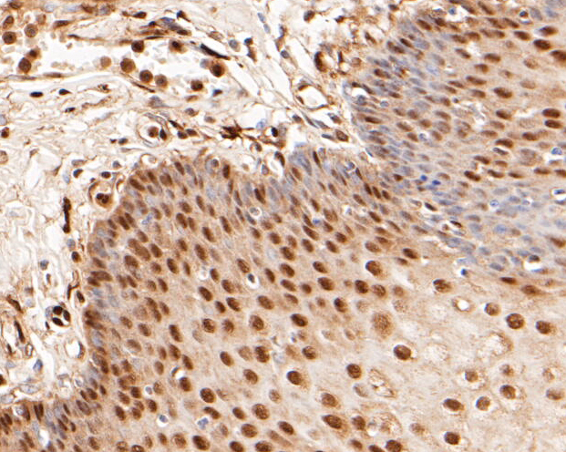 Immunohistochemical analysis of paraffin-embedded human esophagus tissue using anti-LTA4H antibody. The section was pre-treated using heat mediated antigen retrieval with sodium citrate buffer (pH 6.0) for 20 minutes. The tissues were blocked in 5% BSA for 30 minutes at room temperature, washed with ddH2O and PBS, and then probed with the primary antibody (ET7110-13, 1/50)  for 30 minutes at room temperature. The detection was performed using an HRP conjugated compact polymer system. DAB was used as the chromogen. Tissues were counterstained with hematoxylin and mounted with DPX.