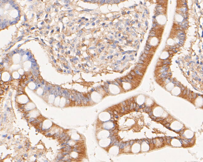 Immunohistochemical analysis of paraffin-embedded human small intestine tissue using anti-Phospho-Met  (pY1349) antibody. The section was pre-treated using heat mediated antigen retrieval with Tris-EDTA buffer (pH 8.0-8.4) for 20 minutes.The tissues were blocked in 5% BSA for 30 minutes at room temperature, washed with ddH2O and PBS, and then probed with the primary antibody (ET7110-14, 1/50) for 30 minutes at room temperature. The detection was performed using an HRP conjugated compact polymer system. DAB was used as the chromogen. Tissues were counterstained with hematoxylin and mounted with DPX.