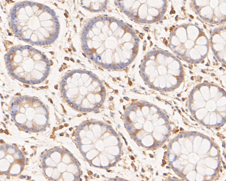 Immunohistochemical analysis of paraffin-embedded human rectum tissue using anti-Phospho-Met  (pY1349) antibody. The section was pre-treated using heat mediated antigen retrieval with Tris-EDTA buffer (pH 8.0-8.4) for 20 minutes.The tissues were blocked in 5% BSA for 30 minutes at room temperature, washed with ddH2O and PBS, and then probed with the primary antibody (ET7110-14, 1/50) for 30 minutes at room temperature. The detection was performed using an HRP conjugated compact polymer system. DAB was used as the chromogen. Tissues were counterstained with hematoxylin and mounted with DPX.