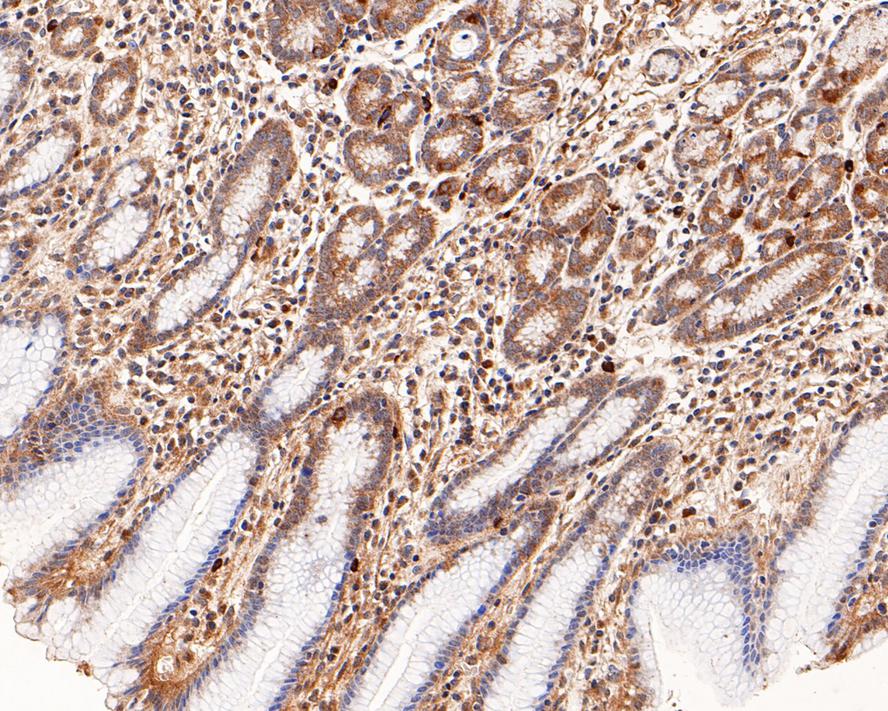 Immunohistochemical analysis of paraffin-embedded human stomach tissue with Rabbit anti-NEK7 antibody (ET7110-16) at 1/800 dilution.<br />
<br />
The section was pre-treated using heat mediated antigen retrieval with Tris-EDTA buffer (pH 9.0) for 20 minutes. The tissues were blocked in 1% BSA for 20 minutes at room temperature, washed with ddH2O and PBS, and then probed with the primary antibody (ET7110-16) at 1/800 dilution for 1 hour at room temperature. The detection was performed using an HRP conjugated compact polymer system. DAB was used as the chromogen. Tissues were counterstained with hematoxylin and mounted with DPX.