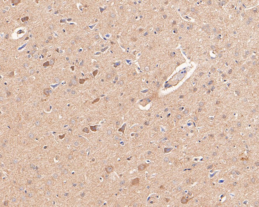 Immunohistochemical analysis of paraffin-embedded rat brain tissue with Rabbit anti-NEK7 antibody (ET7110-16) at 1/800 dilution.<br />
<br />
The section was pre-treated using heat mediated antigen retrieval with Tris-EDTA buffer (pH 9.0) for 20 minutes. The tissues were blocked in 1% BSA for 20 minutes at room temperature, washed with ddH2O and PBS, and then probed with the primary antibody (ET7110-16) at 1/800 dilution for 1 hour at room temperature. The detection was performed using an HRP conjugated compact polymer system. DAB was used as the chromogen. Tissues were counterstained with hematoxylin and mounted with DPX.
