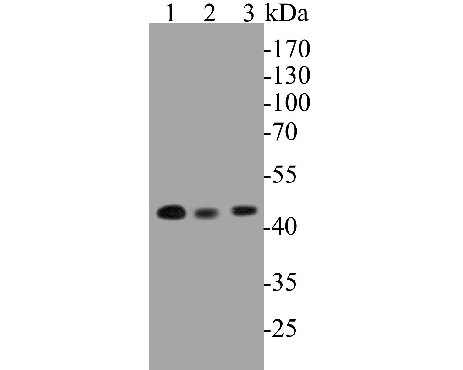 Western blot analysis of NUDC on different lysates. Proteins were transferred to a PVDF membrane and blocked with 5% BSA in PBS for 1 hour at room temperature. The primary antibody (ET7110-18, 1/500) was used in 5% BSA at room temperature for 2 hours. Goat Anti-Rabbit IgG - HRP Secondary Antibody (HA1001) at 1:5,000 dilution was used for 1 hour at room temperature.<br />
Positive control: <br />
Lane 1: K562 cell lysates<br />
Lane 2: PC-3M cell lysates<br />
Lane 3: U937 cell lysates