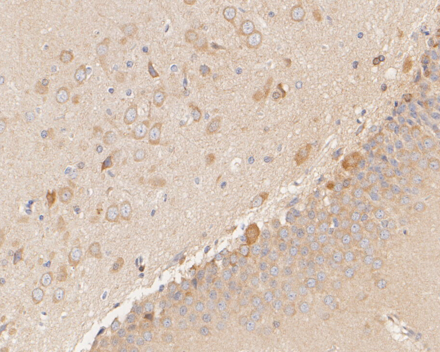 Immunohistochemical analysis of paraffin-embedded rat brain tissue using anti-NUDC antibody. The section was pre-treated using heat mediated antigen retrieval with sodium citrate buffer (pH 6.0) for 20 minutes. The tissues were blocked in 5% BSA for 30 minutes at room temperature, washed with ddH2O and PBS, and then probed with the primary antibody (ET7110-18, 1/200)  for 30 minutes at room temperature. The detection was performed using an HRP conjugated compact polymer system. DAB was used as the chromogen. Tissues were counterstained with hematoxylin and mounted with DPX.