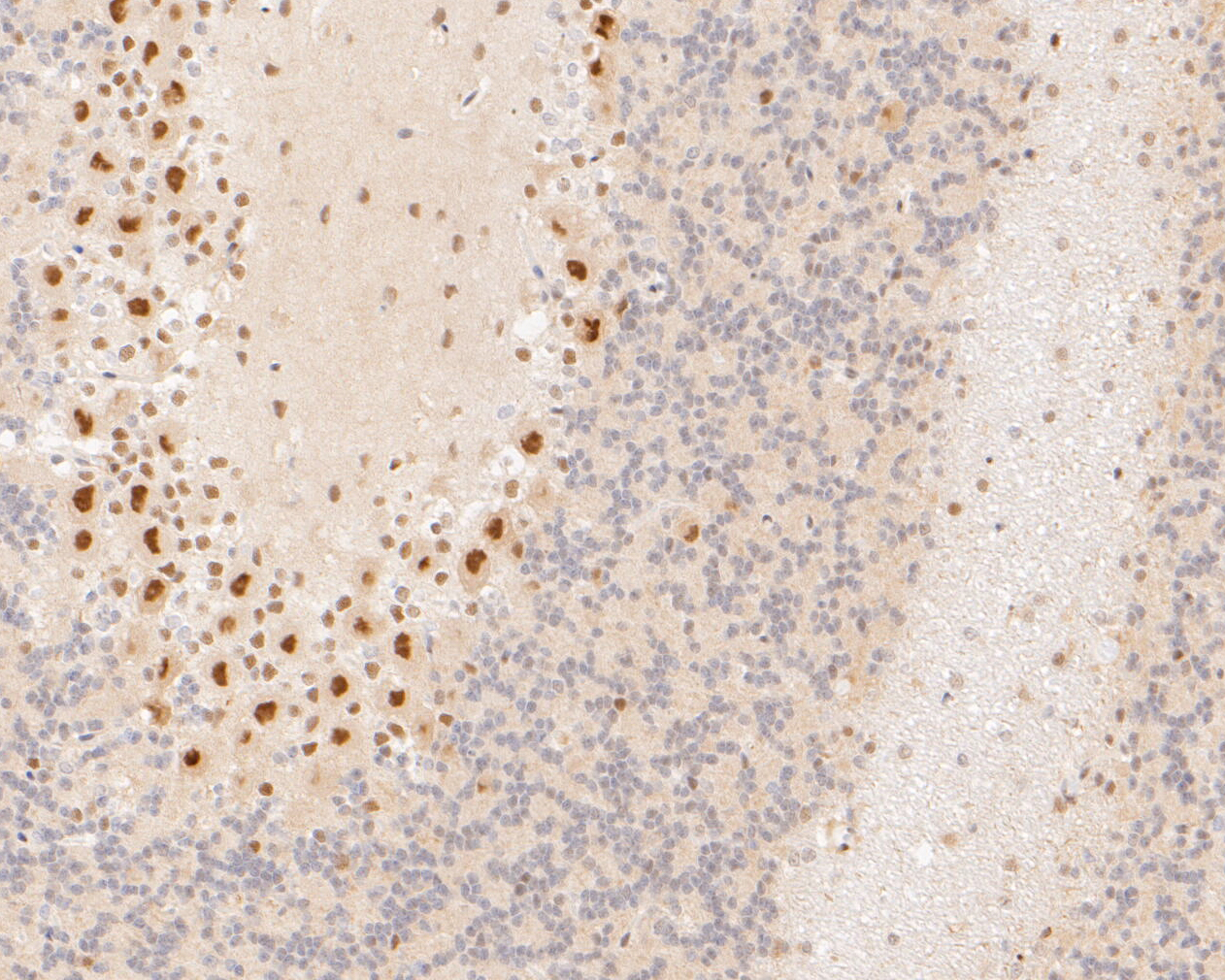 Immunohistochemical analysis of paraffin-embedded rat cerebellum tissue using anti-PSMA2 antibody. The section was pre-treated using heat mediated antigen retrieval with sodium citrate buffer (pH 6.0) for 20 minutes. The tissues were blocked in 5% BSA for 30 minutes at room temperature, washed with ddH2O and PBS, and then probed with the primary antibody (ET7110-19, 1/200)  for 30 minutes at room temperature. The detection was performed using an HRP conjugated compact polymer system. DAB was used as the chromogen. Tissues were counterstained with hematoxylin and mounted with DPX.
