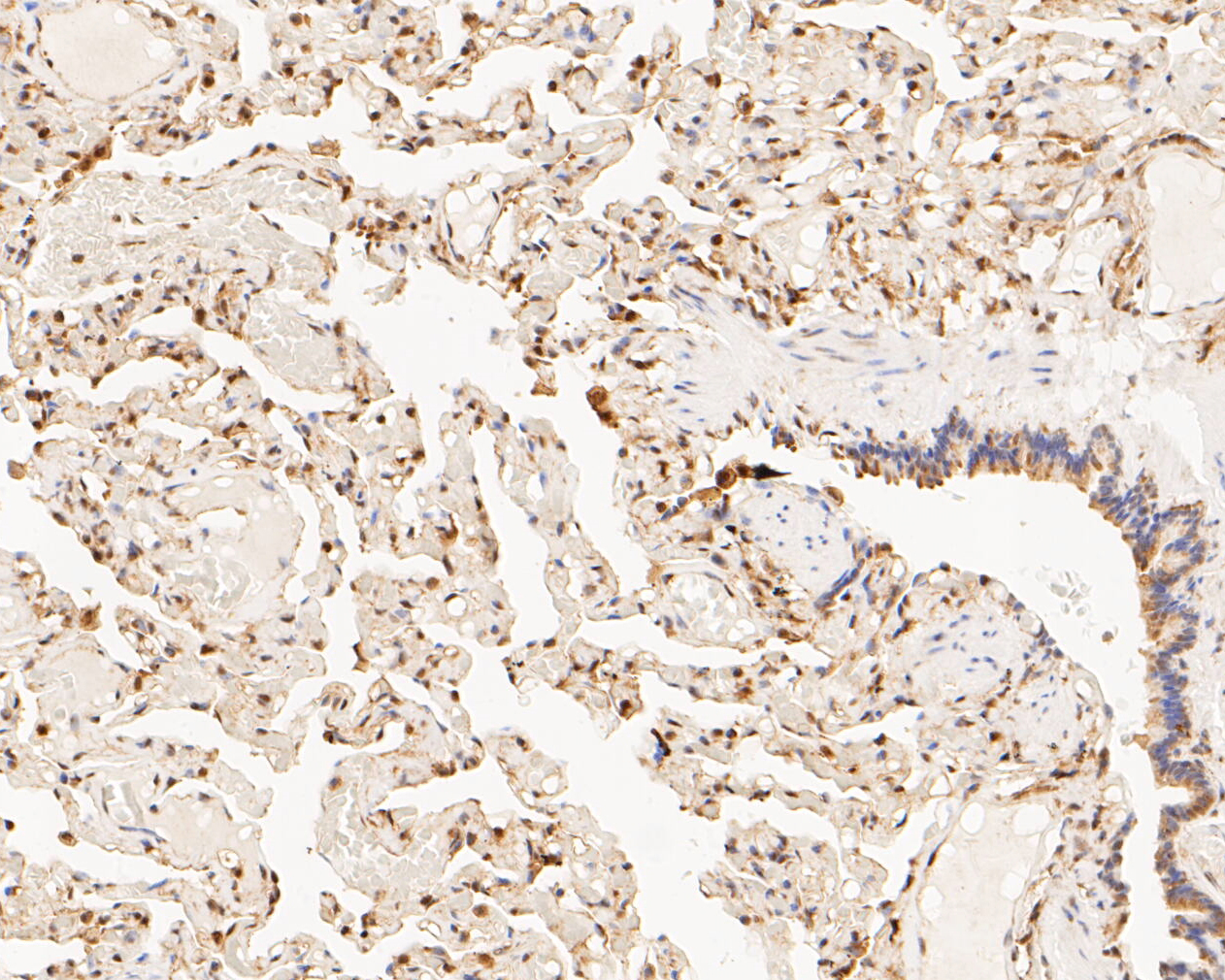 Immunohistochemical analysis of paraffin-embedded human lung tissue using anti-PSMA2 antibody. The section was pre-treated using heat mediated antigen retrieval with sodium citrate buffer (pH 6.0) for 20 minutes. The tissues were blocked in 5% BSA for 30 minutes at room temperature, washed with ddH2O and PBS, and then probed with the primary antibody (ET7110-19, 1/50)  for 30 minutes at room temperature. The detection was performed using an HRP conjugated compact polymer system. DAB was used as the chromogen. Tissues were counterstained with hematoxylin and mounted with DPX.