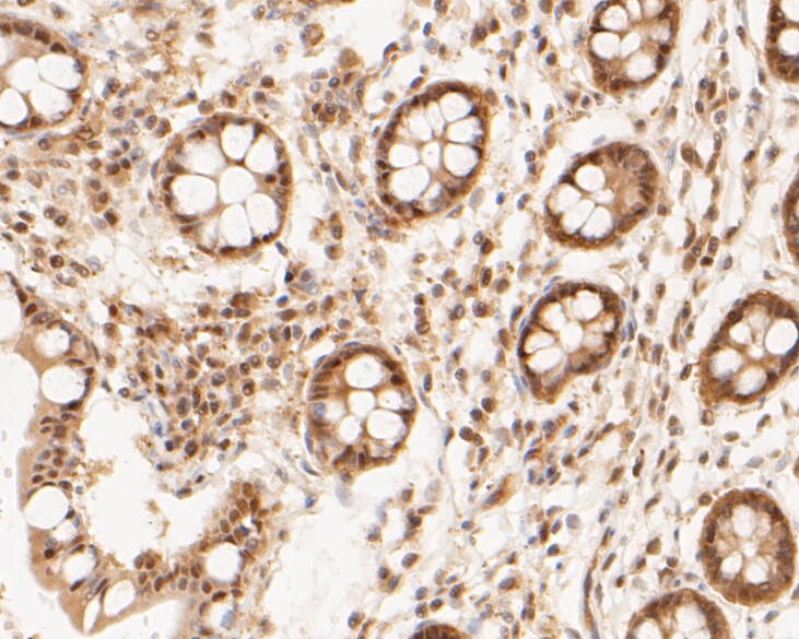 Immunohistochemical analysis of paraffin-embedded human small intestine tissue using anti-PSMA2 antibody. The section was pre-treated using heat mediated antigen retrieval with sodium citrate buffer (pH 6.0) for 20 minutes. The tissues were blocked in 5% BSA for 30 minutes at room temperature, washed with ddH2O and PBS, and then probed with the primary antibody (ET7110-19, 1/50)  for 30 minutes at room temperature. The detection was performed using an HRP conjugated compact polymer system. DAB was used as the chromogen. Tissues were counterstained with hematoxylin and mounted with DPX.