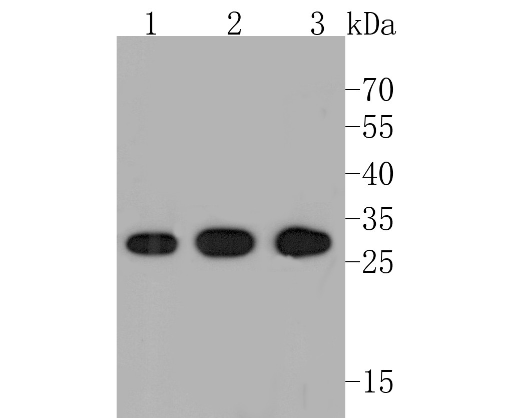 Western blot analysis of PSMA3 on different lysates. Proteins were transferred to a PVDF membrane and blocked with 5% BSA in PBS for 1 hour at room temperature. The primary antibody (ET7110-20, 1/500) was used in 5% BSA at room temperature for 2 hours. Goat Anti-Rabbit IgG - HRP Secondary Antibody (HA1001) at 1:200,000 dilution was used for 1 hour at room temperature.<br />
Positive control: <br />
Lane 1: A549 cell lysate<br />
Lane 2: PC-12 cell lysate<br />
Lane 3: NIH/3T3 cell lysate