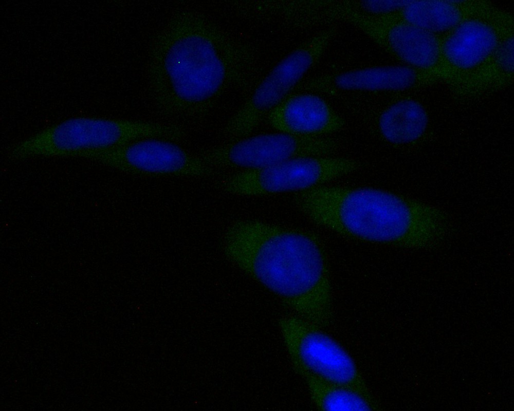 ICC staining of PSMA3 in SW620 cells (green). Formalin fixed cells were permeabilized with 0.1% Triton X-100 in TBS for 10 minutes at room temperature and blocked with 10% negative goat serum for 15 minutes at room temperature. Cells were probed with the primary antibody (ET7110-20, 1/50) for 1 hour at room temperature, washed with PBS. Alexa Fluor®488 conjugate-Goat anti-Rabbit IgG was used as the secondary antibody at 1/1,000 dilution. The nuclear counter stain is DAPI (blue).