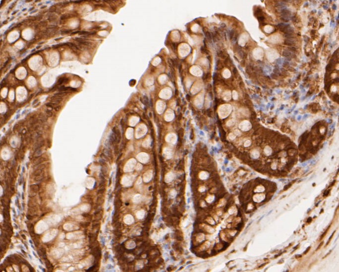 Immunohistochemical analysis of paraffin-embedded rat large intestine tissue using anti-PSMA3 antibody. The section was pre-treated using heat mediated antigen retrieval with sodium citrate buffer (pH 6.0) for 20 minutes. The tissues were blocked in 5% BSA for 30 minutes at room temperature, washed with ddH2O and PBS, and then probed with the primary antibody (ET7110-20, 1/50)  for 30 minutes at room temperature. The detection was performed using an HRP conjugated compact polymer system. DAB was used as the chromogen. Tissues were counterstained with hematoxylin and mounted with DPX.