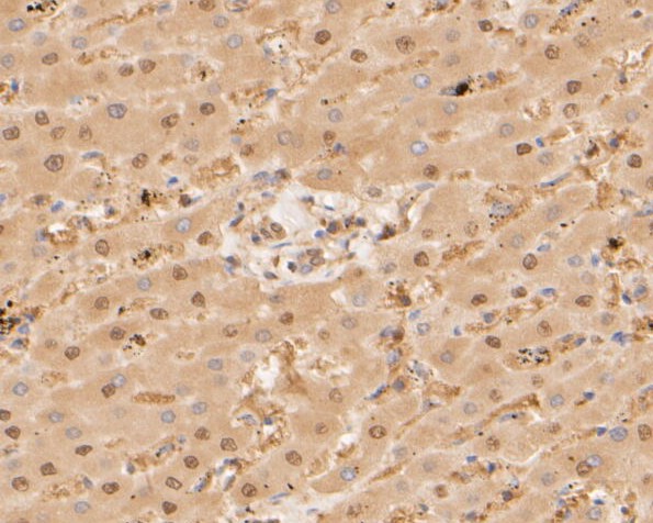 Immunohistochemical analysis of paraffin-embedded human liver tissue using anti-PSMA3 antibody. The section was pre-treated using heat mediated antigen retrieval with sodium citrate buffer (pH 6.0) for 20 minutes. The tissues were blocked in 5% BSA for 30 minutes at room temperature, washed with ddH2O and PBS, and then probed with the primary antibody (ET7110-20, 1/50)  for 30 minutes at room temperature. The detection was performed using an HRP conjugated compact polymer system. DAB was used as the chromogen. Tissues were counterstained with hematoxylin and mounted with DPX.