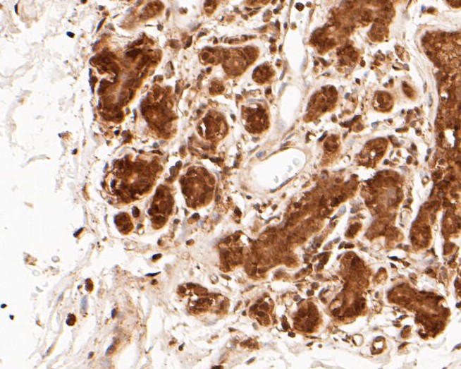 Immunohistochemical analysis of paraffin-embedded human breast tissue using anti-PSMA3 antibody. The section was pre-treated using heat mediated antigen retrieval with sodium citrate buffer (pH 6.0) for 20 minutes. The tissues were blocked in 5% BSA for 30 minutes at room temperature, washed with ddH2O and PBS, and then probed with the primary antibody (ET7110-20, 1/50)  for 30 minutes at room temperature. The detection was performed using an HRP conjugated compact polymer system. DAB was used as the chromogen. Tissues were counterstained with hematoxylin and mounted with DPX.