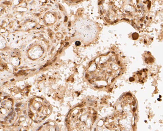 Immunohistochemical analysis of paraffin-embedded human placenta tissue using anti-PSMA3 antibody. The section was pre-treated using heat mediated antigen retrieval with sodium citrate buffer (pH 6.0) for 20 minutes. The tissues were blocked in 5% BSA for 30 minutes at room temperature, washed with ddH2O and PBS, and then probed with the primary antibody (ET7110-20, 1/50)  for 30 minutes at room temperature. The detection was performed using an HRP conjugated compact polymer system. DAB was used as the chromogen. Tissues were counterstained with hematoxylin and mounted with DPX.