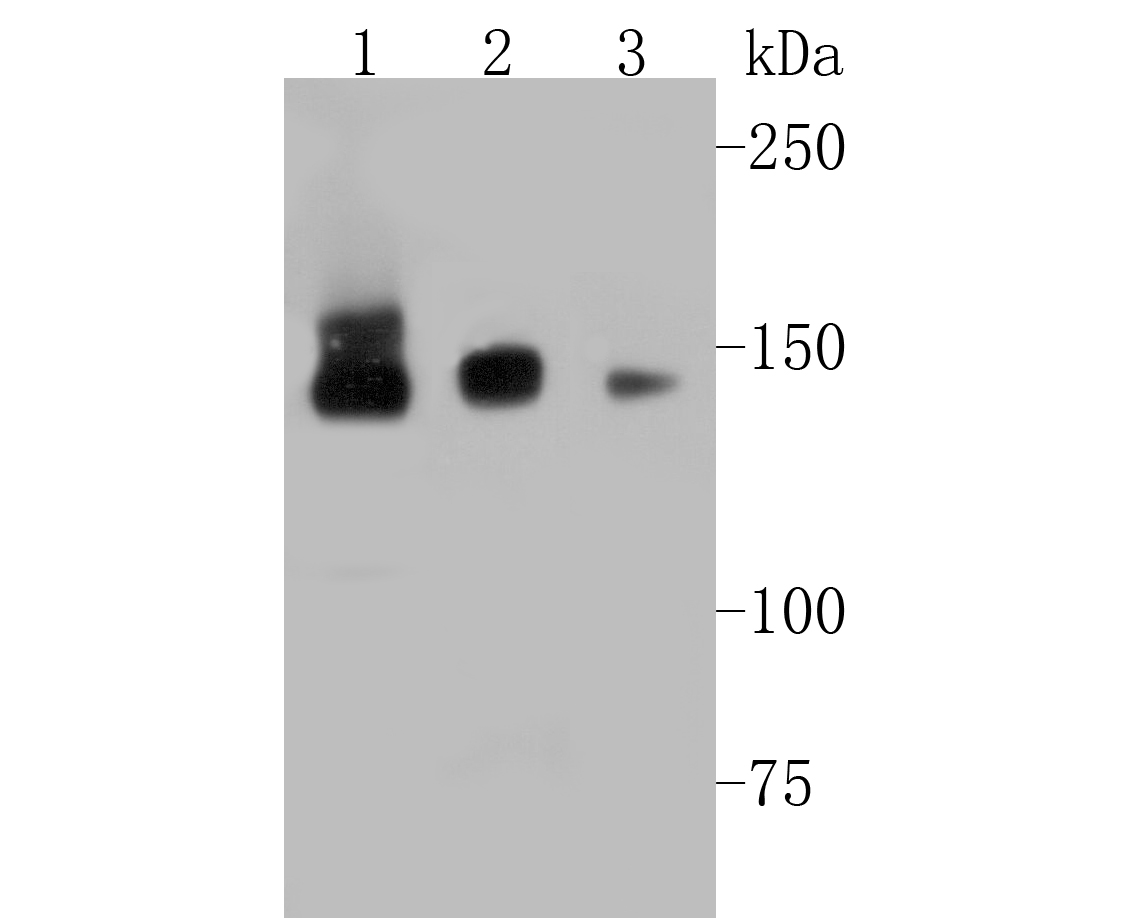 Western blot analysis of Timeless on different lysates. Proteins were transferred to a PVDF membrane and blocked with 5% BSA in PBS for 1 hour at room temperature. The primary antibody (ET7110-23, 1/500) was used in 5% BSA at room temperature for 2 hours. Goat Anti-Rabbit IgG - HRP Secondary Antibody (HA1001) at 1:5,000 dilution was used for 1 hour at room temperature.<br />
Positive control: <br />
Lane 1: Hela cell lysate<br />
Lane 2: 293T cell lysate<br />
Lane 3: Daudi cell lysate