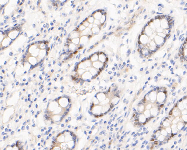 Immunohistochemical analysis of paraffin-embedded human small intestine tissue using anti-Timeless antibody. The section was pre-treated using heat mediated antigen retrieval with sodium citrate buffer (pH 6.0) for 20 minutes. The tissues were blocked in 5% BSA for 30 minutes at room temperature, washed with ddH2O and PBS, and then probed with the primary antibody (ET7110-23, 1/50)  for 30 minutes at room temperature. The detection was performed using an HRP conjugated compact polymer system. DAB was used as the chromogen. Tissues were counterstained with hematoxylin and mounted with DPX.