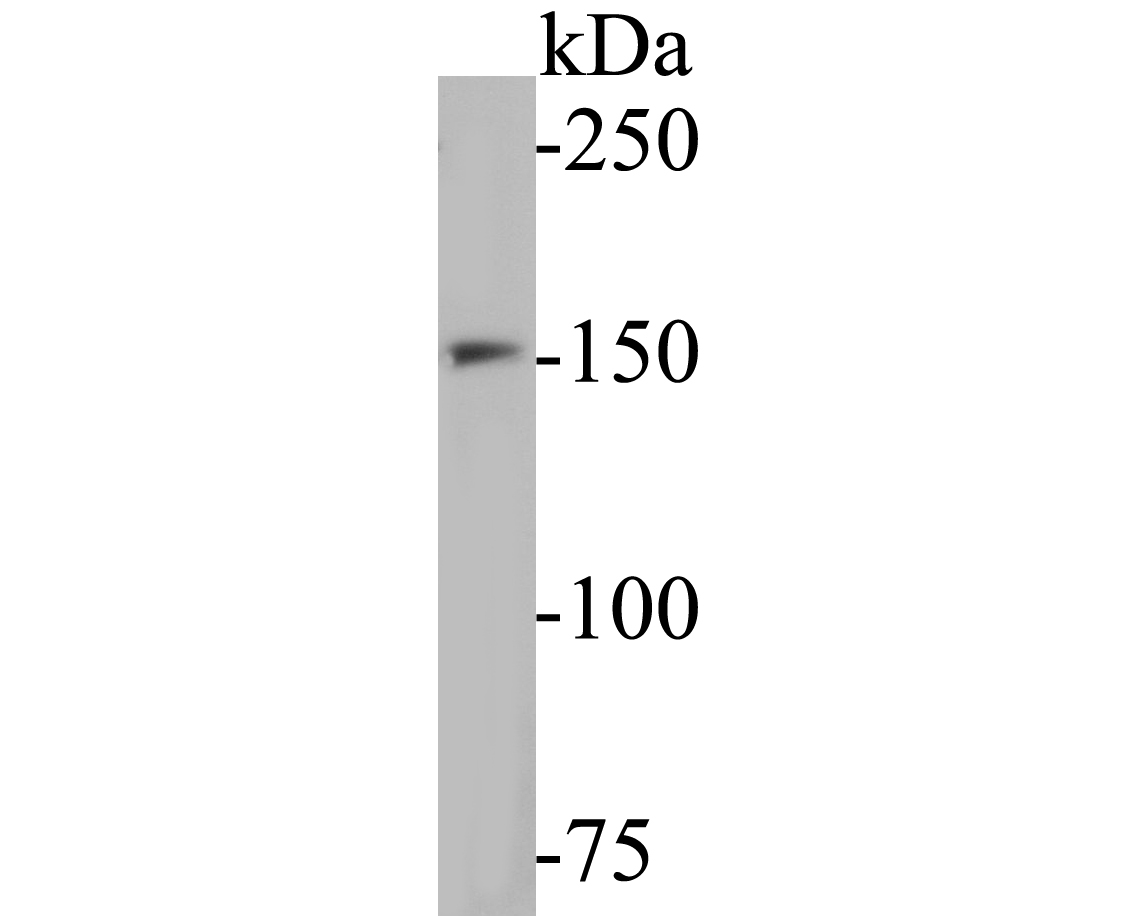 Western blot analysis of WRN on K562 cell lysates. Proteins were transferred to a PVDF membrane and blocked with 5% BSA in PBS for 1 hour at room temperature. The primary antibody (ET7110-26, 1/500) was used in 5% BSA at room temperature for 2 hours. Goat Anti-Rabbit IgG - HRP Secondary Antibody (HA1001) at 1:5,000 dilution was used for 1 hour at room temperature.