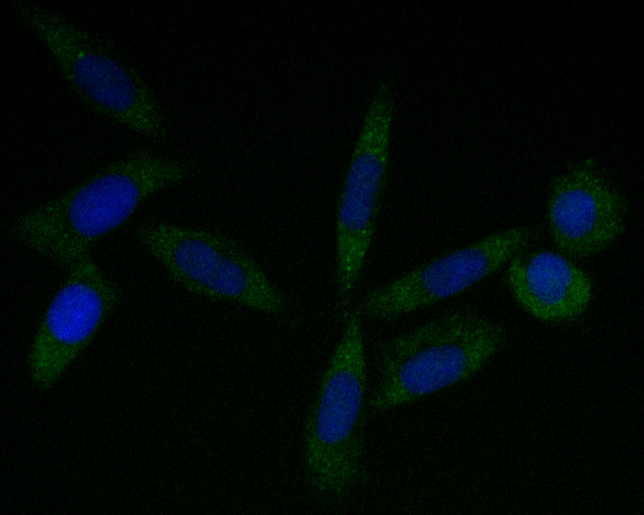 ICC staining of Tropomodulin 2 in SiHa cells (green). Formalin fixed cells were permeabilized with 0.1% Triton X-100 in TBS for 10 minutes at room temperature and blocked with 1% Blocker BSA for 15 minutes at room temperature. Cells were probed with the primary antibody (ET7110-27, 1/50) for 1 hour at room temperature, washed with PBS. Alexa Fluor®488 Goat anti-Rabbit IgG was used as the secondary antibody at 1/1,000 dilution. The nuclear counter stain is DAPI (blue).