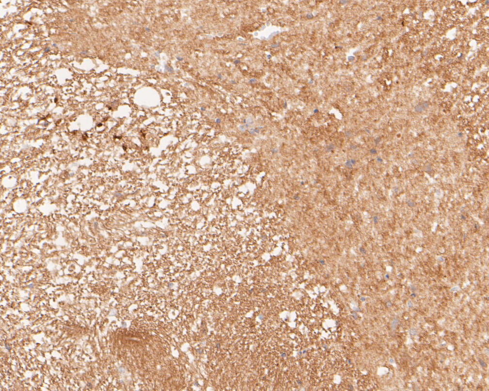 Immunohistochemical analysis of paraffin-embedded rat spinal cord tissue using anti-Tropomodulin 2 antibody. The section was pre-treated using heat mediated antigen retrieval with Tris-EDTA buffer (pH 8.0-8.4) for 20 minutes.The tissues were blocked in 5% BSA for 30 minutes at room temperature, washed with ddH2O and PBS, and then probed with the primary antibody (ET7110-27, 1/50) for 30 minutes at room temperature. The detection was performed using an HRP conjugated compact polymer system. DAB was used as the chromogen. Tissues were counterstained with hematoxylin and mounted with DPX.