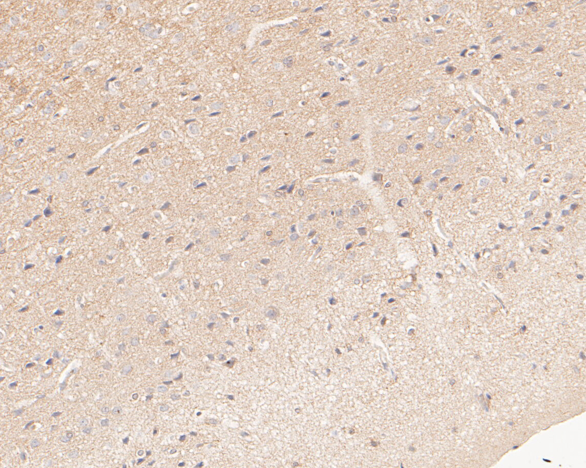 Immunohistochemical analysis of paraffin-embedded rat brain tissue using anti-Tropomodulin 2 antibody. The section was pre-treated using heat mediated antigen retrieval with Tris-EDTA buffer (pH 8.0-8.4) for 20 minutes.The tissues were blocked in 5% BSA for 30 minutes at room temperature, washed with ddH2O and PBS, and then probed with the primary antibody (ET7110-27, 1/50) for 30 minutes at room temperature. The detection was performed using an HRP conjugated compact polymer system. DAB was used as the chromogen. Tissues were counterstained with hematoxylin and mounted with DPX.