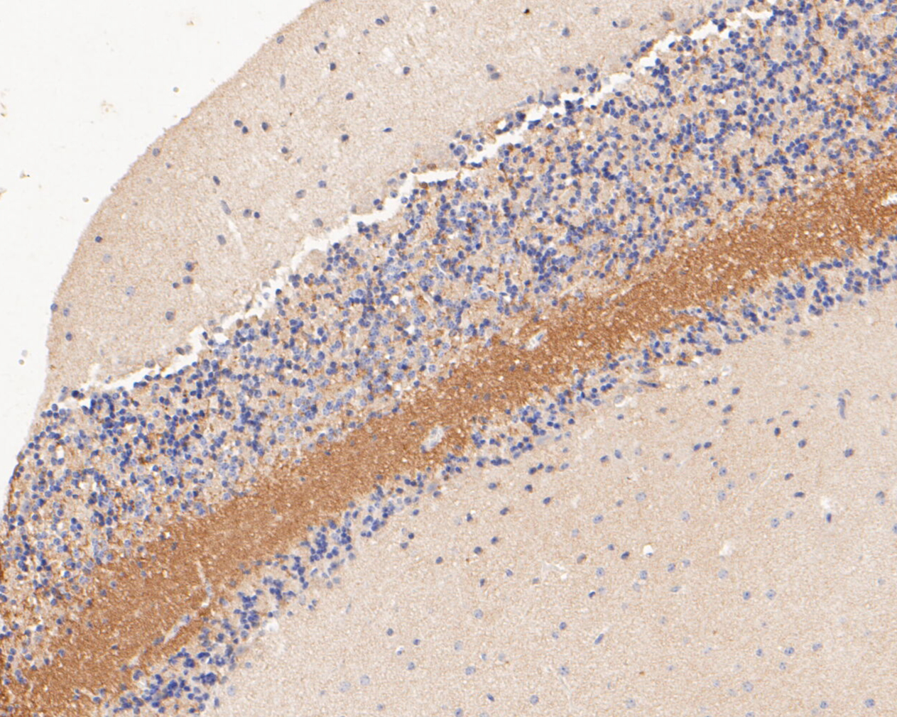 Immunohistochemical analysis of paraffin-embedded mouse cerebellum tissue using anti-Tropomodulin 2 antibody. The section was pre-treated using heat mediated antigen retrieval with Tris-EDTA buffer (pH 8.0-8.4) for 20 minutes.The tissues were blocked in 5% BSA for 30 minutes at room temperature, washed with ddH2O and PBS, and then probed with the primary antibody (ET7110-27, 1/50) for 30 minutes at room temperature. The detection was performed using an HRP conjugated compact polymer system. DAB was used as the chromogen. Tissues were counterstained with hematoxylin and mounted with DPX.