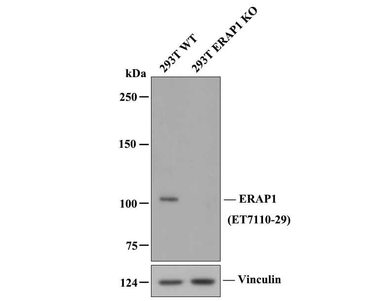 All lanes: Western blot analysis of ERAP1 with anti-ERAP1 antibody [JE52-36] (ET7110-29) at 1/500 dilution.<br />
Lane 1: Wild-type 293T whole cell lysate.<br />
Lane 2: ERAP1 knockout 293T whole cell lysate.<br />
<br />
ET7110-29 was shown to specifically react with ERAP1 in wild-type 293T cells. No band was observed when ERAP1 knockout sample was tested. Wild-type and ERAP1 knockout samples were subjected to SDS-PAGE. Proteins were transferred to a PVDF membrane and blocked with 5% NFDM in TBST for 1 hour at room temperature. The primary Anti-ERAP1 antibody (ET7110-29, 1/500) and Anti-β-actin antibody (R1207-1, 1/1,000) were used in 5% BSA at room temperature for 2 hours. Goat Anti-Rabbit IgG H&L (HRP) Secondary Antibody (HA1001) at 1:200,000 dilution was used for 1 hour at room temperature.