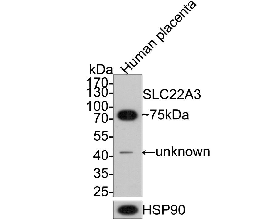 Western blot analysis of SLC22A3 on human placenta tissue lysates with Rabbit anti-SLC22A3 antibody (ET7110-35) at 1/2,000 dilution.<br />
<br />
Lysates/proteins at 20 µg/Lane.<br />
<br />
Predicted band size: 61 kDa<br />
Observed band size: 75 kDa<br />
<br />
Exposure time: 2 minutes;<br />
<br />
10% SDS-PAGE gel.<br />
<br />
Proteins were transferred to a PVDF membrane and blocked with 5% NFDM/TBST for 1 hour at room temperature. The primary antibody (ET7110-35) at 1/2,000 dilution was used in 5% NFDM/TBST at room temperature for 2 hours. Goat Anti-Rabbit IgG - HRP Secondary Antibody (HA1001) at 1:200,000 dilution was used for 1 hour at room temperature.