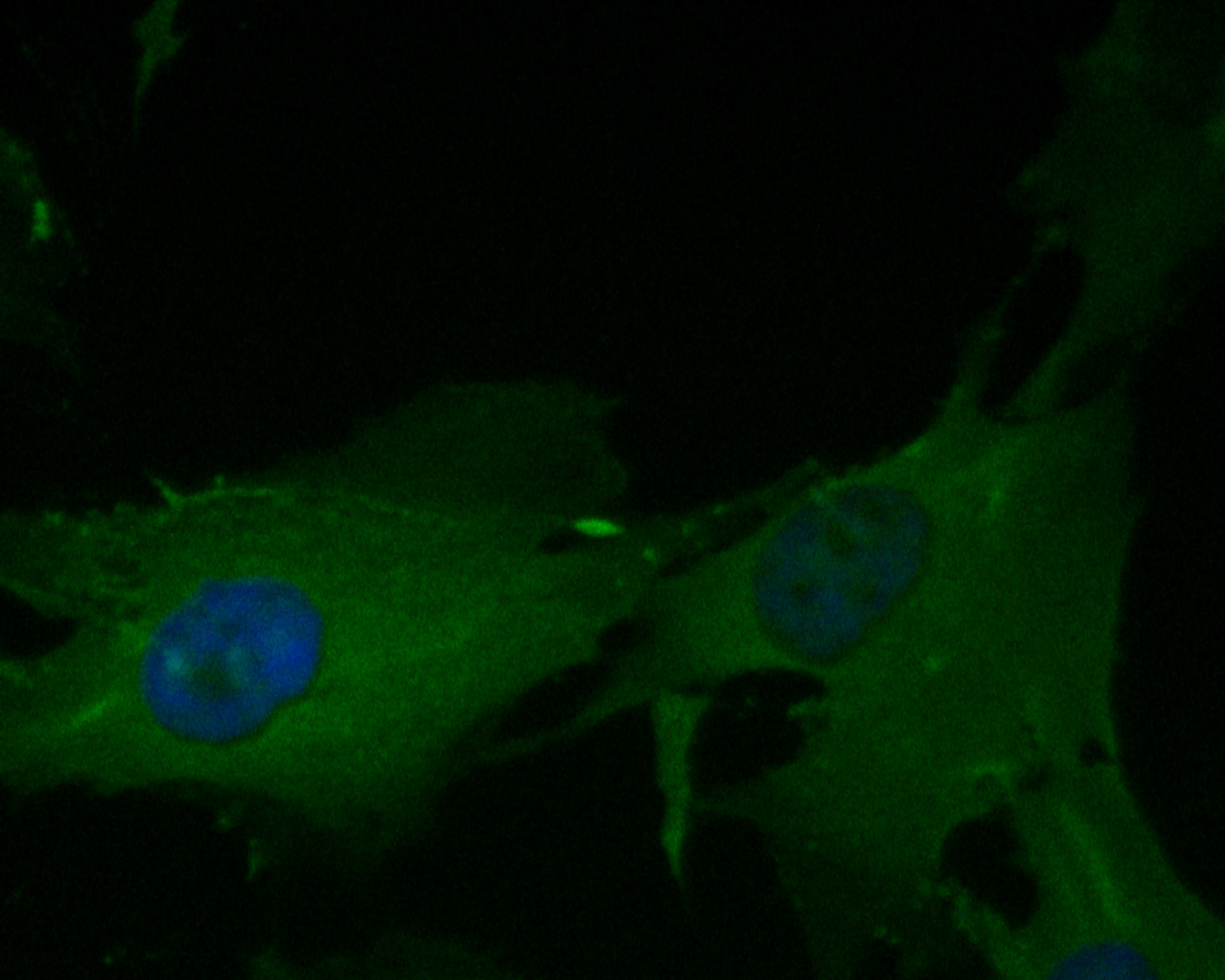 ICC staining of eIF3B in MG-63 cells (green). Formalin fixed cells were permeabilized with 0.1% Triton X-100 in TBS for 10 minutes at room temperature and blocked with 1% Blocker BSA for 15 minutes at room temperature. Cells were probed with the primary antibody (ET7110-36, 1/200) for 1 hour at room temperature, washed with PBS. Alexa Fluor®488 Goat anti-Rabbit IgG was used as the secondary antibody at 1/1,000 dilution. The nuclear counter stain is DAPI (blue).