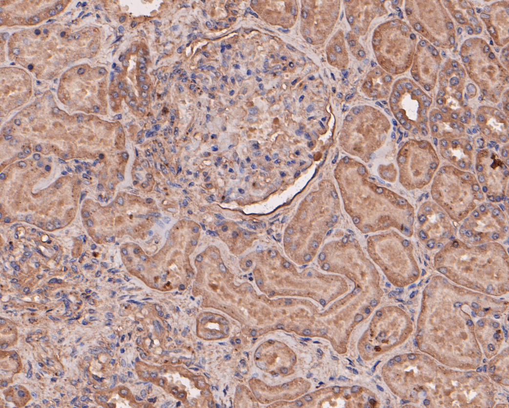 Immunohistochemical analysis of paraffin-embedded human kidney tissue using anti-eIF3B antibody. The section was pre-treated using heat mediated antigen retrieval with Tris-EDTA buffer (pH 8.0-8.4) for 20 minutes.The tissues were blocked in 5% BSA for 30 minutes at room temperature, washed with ddH2O and PBS, and then probed with the primary antibody (ET7110-36, 1/50) for 30 minutes at room temperature. The detection was performed using an HRP conjugated compact polymer system. DAB was used as the chromogen. Tissues were counterstained with hematoxylin and mounted with DPX.