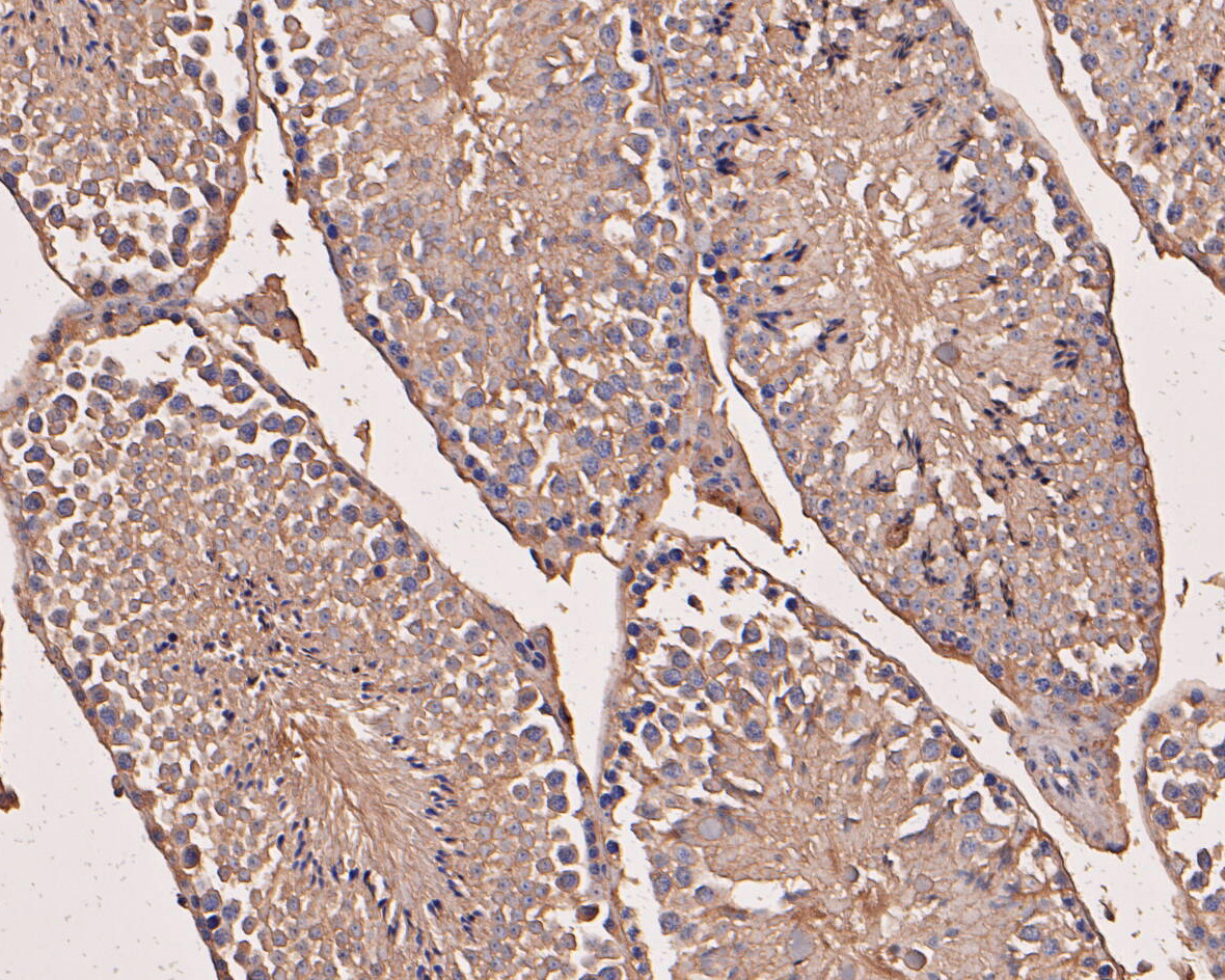 Immunohistochemical analysis of paraffin-embedded mouse testis tissue using anti-eIF3B antibody. The section was pre-treated using heat mediated antigen retrieval with Tris-EDTA buffer (pH 8.0-8.4) for 20 minutes.The tissues were blocked in 5% BSA for 30 minutes at room temperature, washed with ddH2O and PBS, and then probed with the primary antibody (ET7110-36, 1/50) for 30 minutes at room temperature. The detection was performed using an HRP conjugated compact polymer system. DAB was used as the chromogen. Tissues were counterstained with hematoxylin and mounted with DPX.