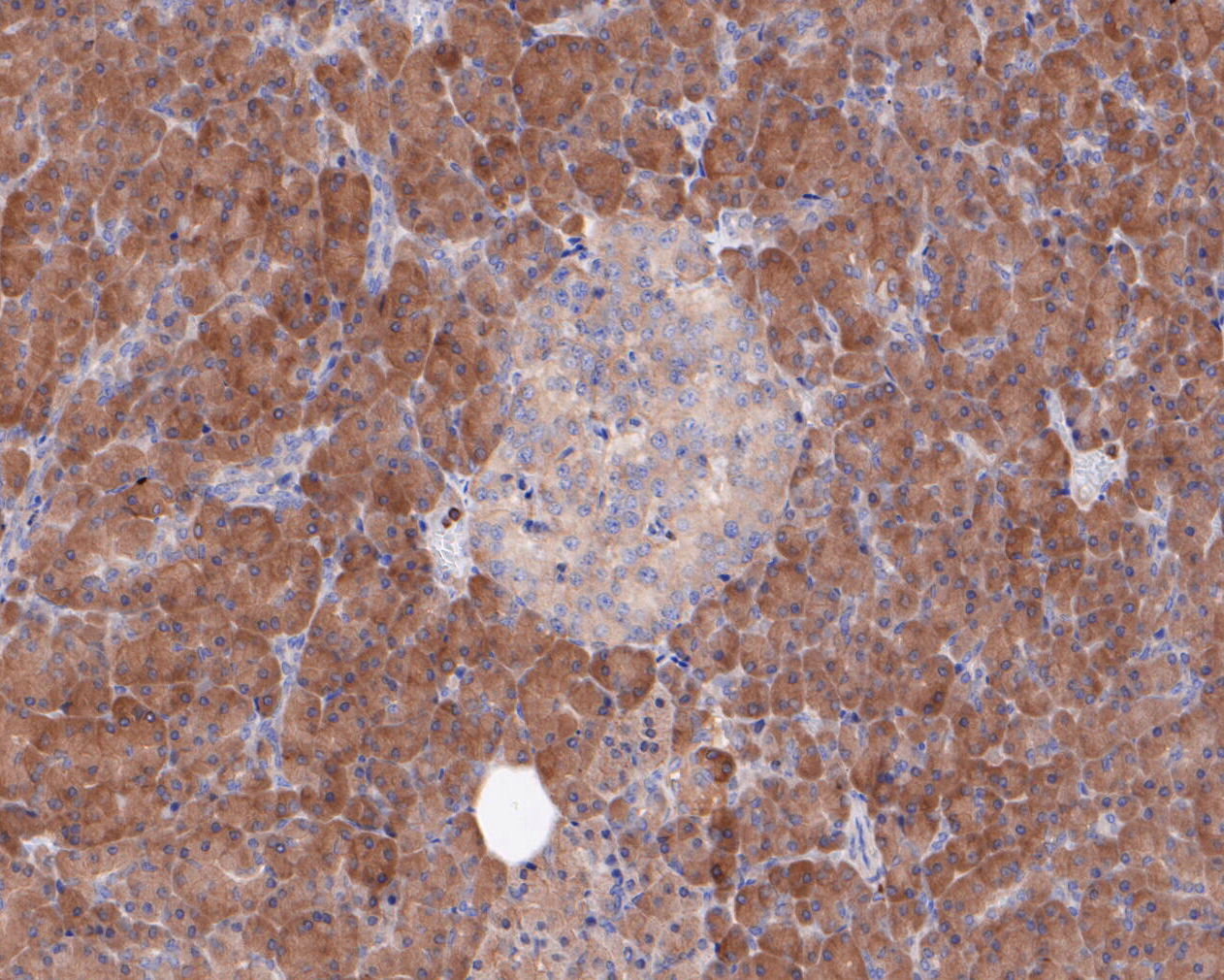 Immunohistochemical analysis of paraffin-embedded human pancreas tissue using anti-SPAK antibody. The section was pre-treated using heat mediated antigen retrieval with sodium citrate buffer (pH 6.0) for 20 minutes. The tissues were blocked in 5% BSA for 30 minutes at room temperature, washed with ddH2O and PBS, and then probed with the primary antibody (ET7110-37, 1/50)  for 30 minutes at room temperature. The detection was performed using an HRP conjugated compact polymer system. DAB was used as the chromogen. Tissues were counterstained with hematoxylin and mounted with DPX.