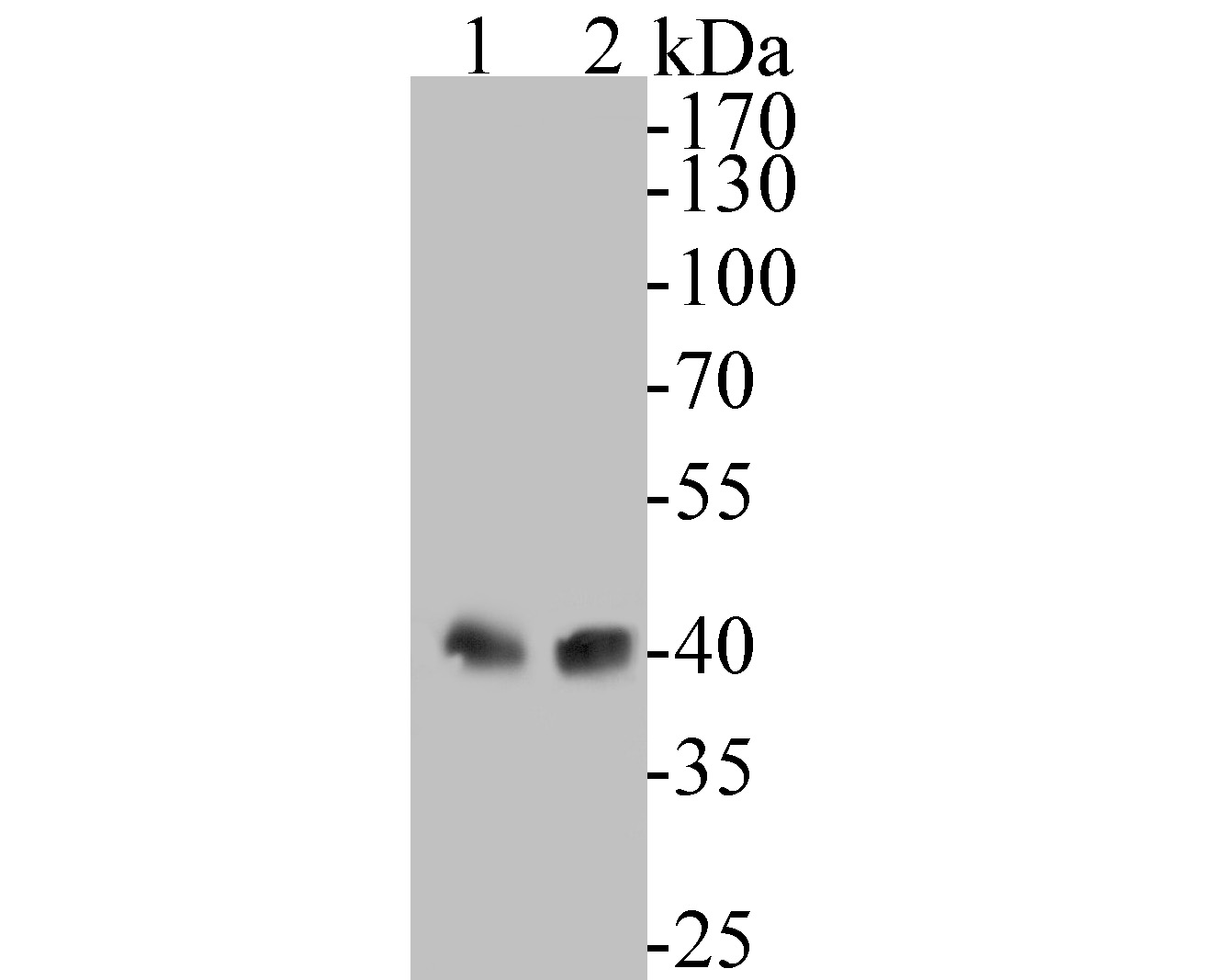 Western blot analysis of HLA F on different lysates. Proteins were transferred to a PVDF membrane and blocked with 5% BSA in PBS for 1 hour at room temperature. The primary antibody (ET7110-39, 1/500) was used in 5% BSA at room temperature for 2 hours. Goat Anti-Rabbit IgG - HRP Secondary Antibody (HA1001) at 1:5,000 dilution was used for 1 hour at room temperature.<br />
Positive control: <br />
Lane 1: Human thymus tissue lysate<br />
Lane 2: Human spleen tissue lysate