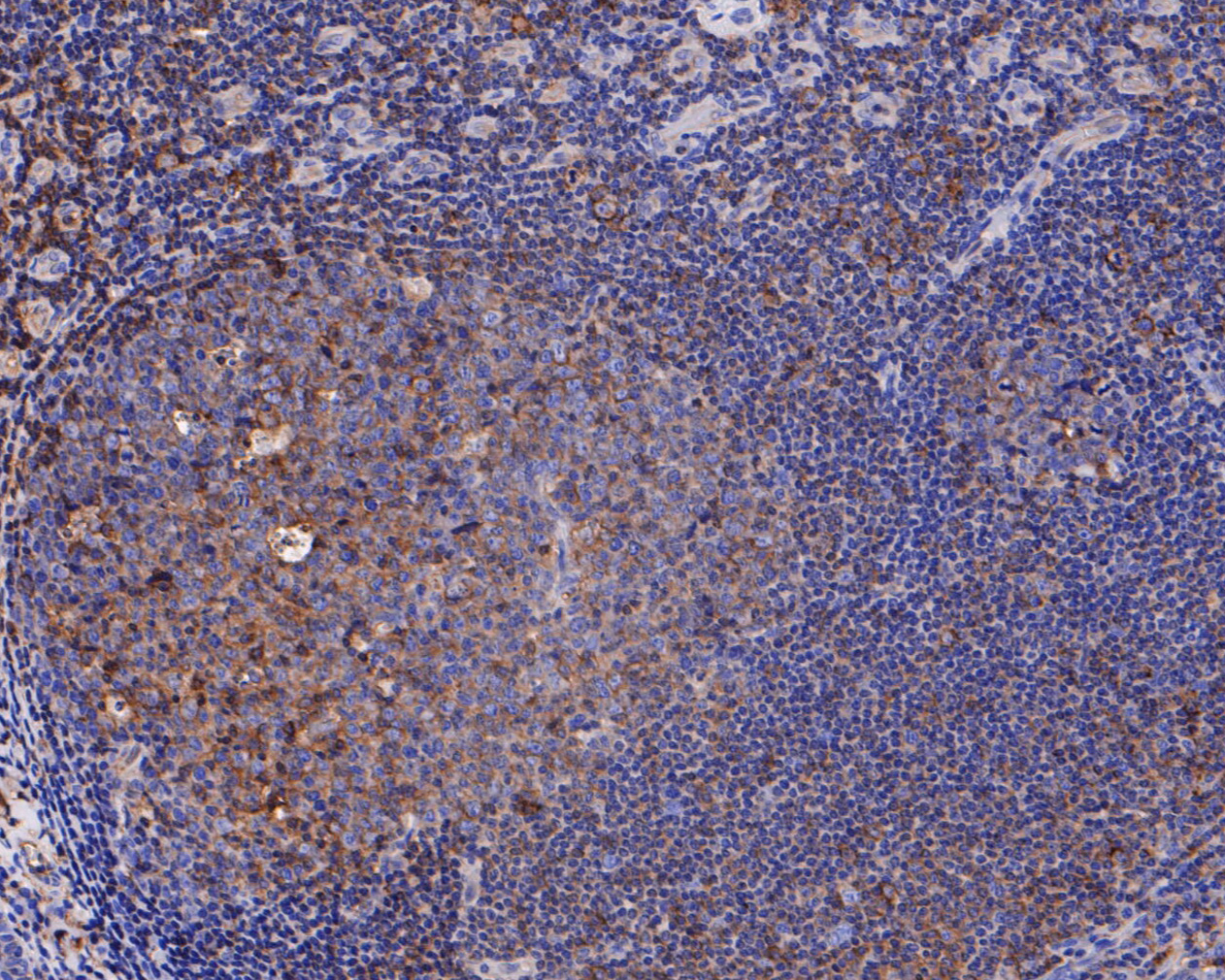 Immunohistochemical analysis of paraffin-embedded human tonsil tissue using anti-HLA F antibody. The section was pre-treated using heat mediated antigen retrieval with Tris-EDTA buffer (pH 8.0-8.4) for 20 minutes.The tissues were blocked in 5% BSA for 30 minutes at room temperature, washed with ddH2O and PBS, and then probed with the primary antibody (ET7110-39, 1/50) for 30 minutes at room temperature. The detection was performed using an HRP conjugated compact polymer system. DAB was used as the chromogen. Tissues were counterstained with hematoxylin and mounted with DPX.