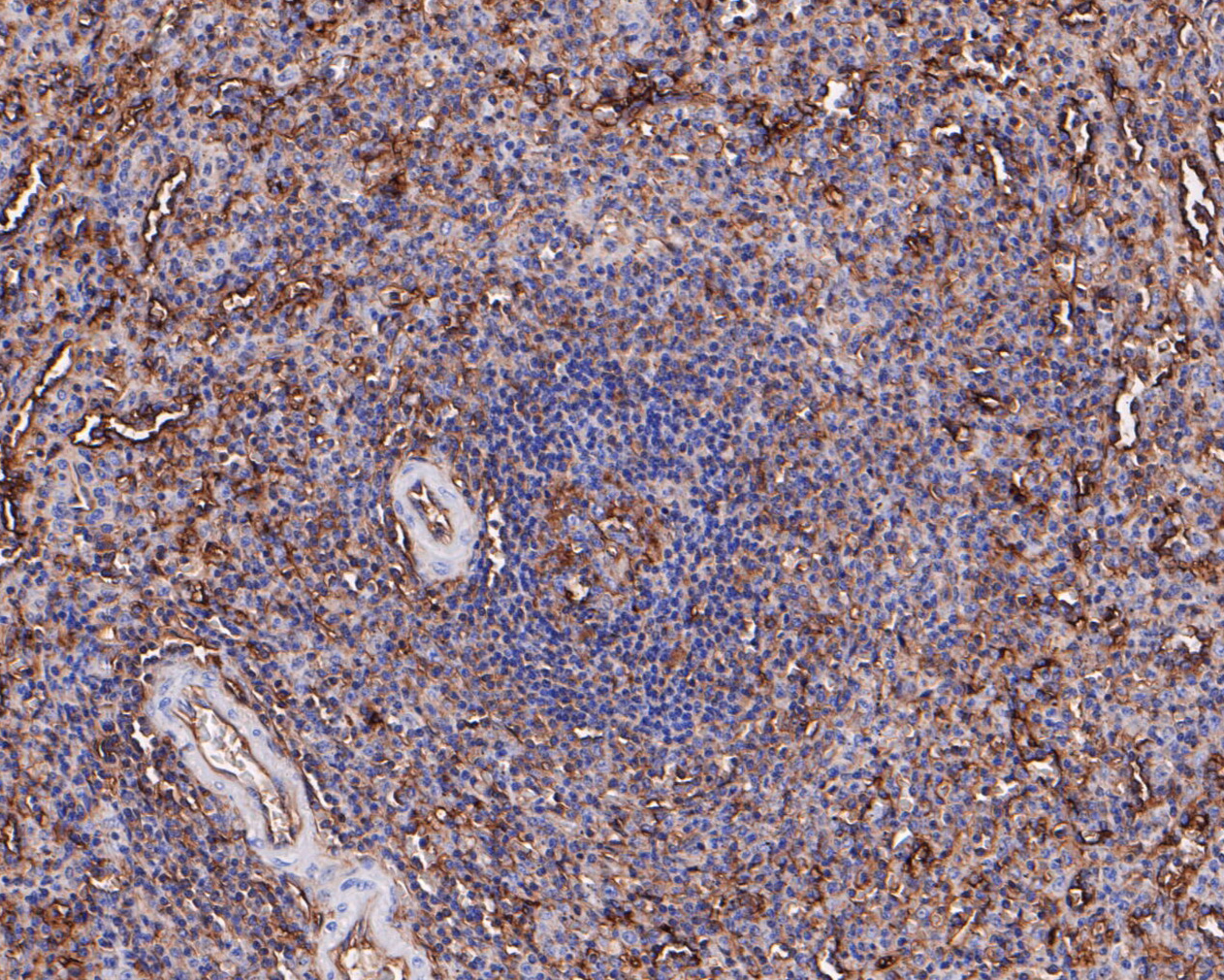 Immunohistochemical analysis of paraffin-embedded human spleen tissue using anti-HLA F antibody. The section was pre-treated using heat mediated antigen retrieval with Tris-EDTA buffer (pH 8.0-8.4) for 20 minutes.The tissues were blocked in 5% BSA for 30 minutes at room temperature, washed with ddH2O and PBS, and then probed with the primary antibody (ET7110-39, 1/50) for 30 minutes at room temperature. The detection was performed using an HRP conjugated compact polymer system. DAB was used as the chromogen. Tissues were counterstained with hematoxylin and mounted with DPX.