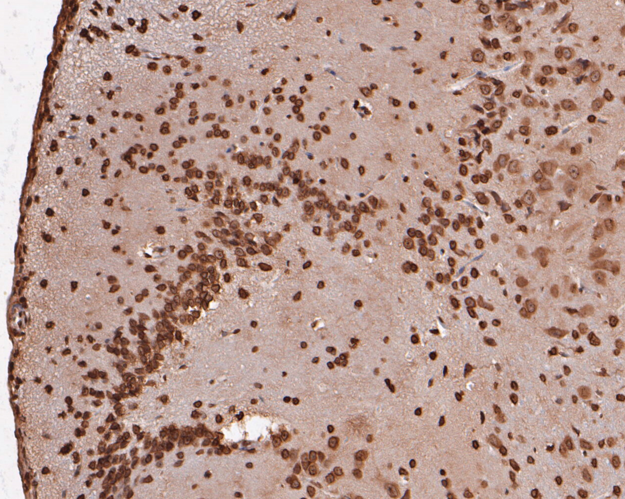 Immunohistochemical analysis of paraffin-embedded rat brain tissue using anti-eIF3e antibody. The section was pre-treated using heat mediated antigen retrieval with sodium citrate buffer (pH 6.0) for 20 minutes. The tissues were blocked in 5% BSA for 30 minutes at room temperature, washed with ddH2O and PBS, and then probed with the primary antibody (ET7110-40, 1/50)  for 30 minutes at room temperature. The detection was performed using an HRP conjugated compact polymer system. DAB was used as the chromogen. Tissues were counterstained with hematoxylin and mounted with DPX.