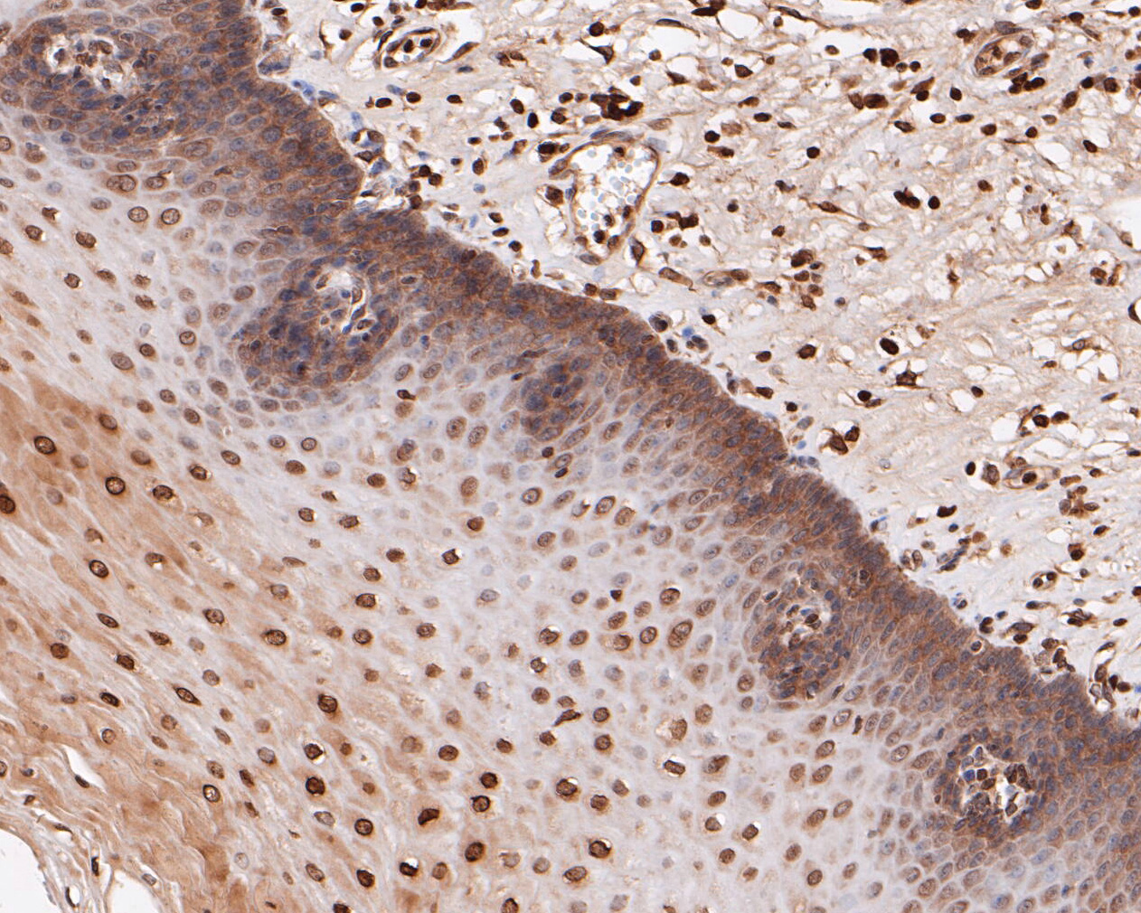 Immunohistochemical analysis of paraffin-embedded human esophagus tissue using anti-eIF3e antibody. The section was pre-treated using heat mediated antigen retrieval with sodium citrate buffer (pH 6.0) for 20 minutes. The tissues were blocked in 5% BSA for 30 minutes at room temperature, washed with ddH2O and PBS, and then probed with the primary antibody (ET7110-40, 1/50)  for 30 minutes at room temperature. The detection was performed using an HRP conjugated compact polymer system. DAB was used as the chromogen. Tissues were counterstained with hematoxylin and mounted with DPX.