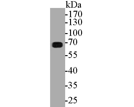 Western blot analysis of ECM1 on rat heart tissue lysates. Proteins were transferred to a PVDF membrane and blocked with 5% BSA in PBS for 1 hour at room temperature. The primary antibody (ET7110-41, 1/2000) was used in 5% BSA at room temperature for 2 hours. Goat Anti-Rabbit IgG - HRP Secondary Antibody (HA1001) at 1:5,000 dilution was used for 1 hour at room temperature.