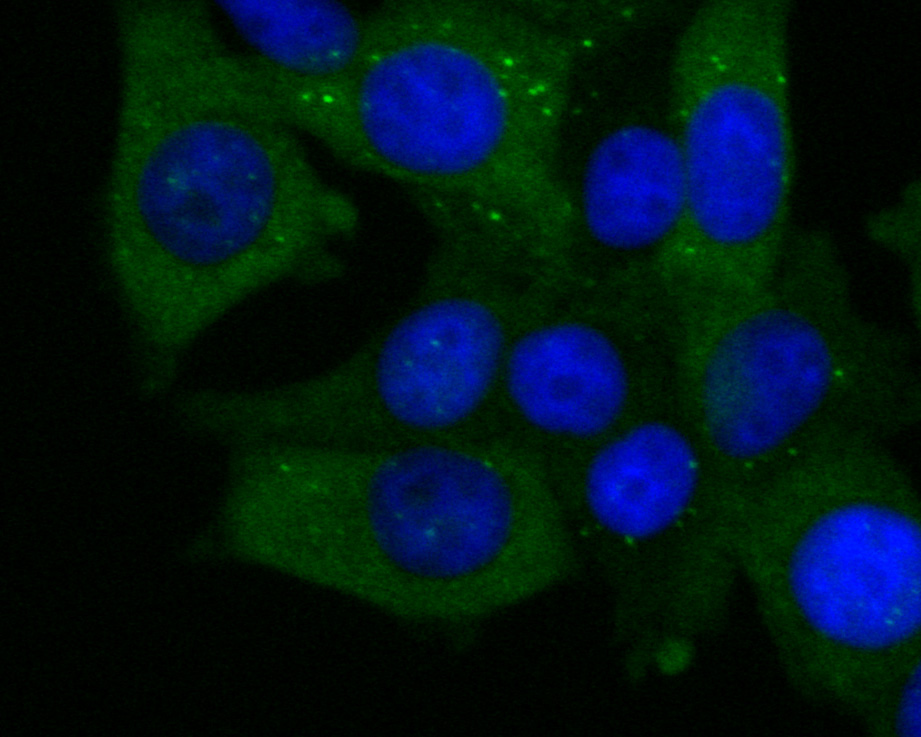 ICC staining of ECM1 in MCF-7 cells (green). Formalin fixed cells were permeabilized with 0.1% Triton X-100 in TBS for 10 minutes at room temperature and blocked with 1% Blocker BSA for 15 minutes at room temperature. Cells were probed with the primary antibody (ET7110-41, 1/50) for 1 hour at room temperature, washed with PBS. Alexa Fluor®488 Goat anti-Rabbit IgG was used as the secondary antibody at 1/1,000 dilution. The nuclear counter stain is DAPI (blue).