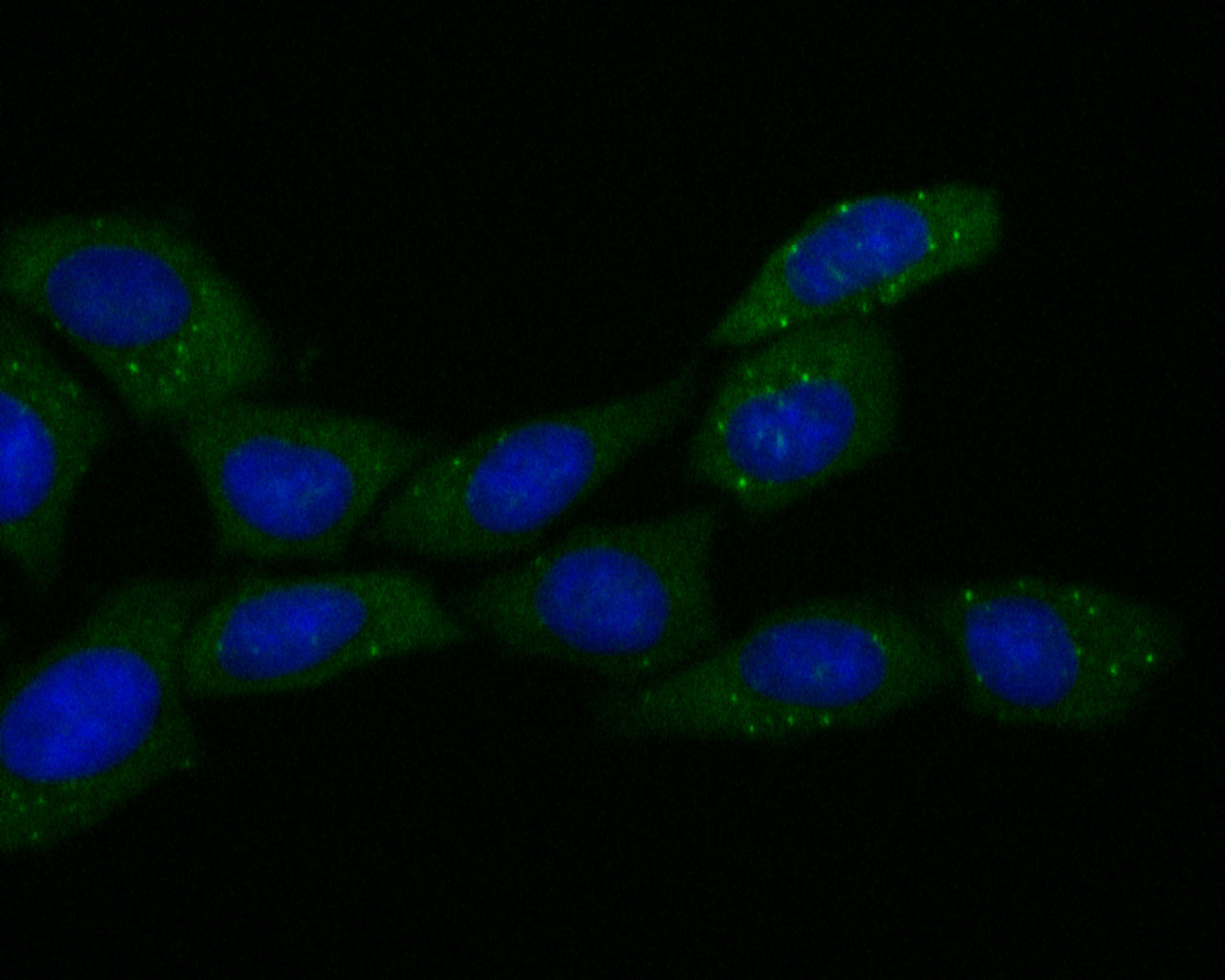 ICC staining of ECM1 in SiHa cells (green). Formalin fixed cells were permeabilized with 0.1% Triton X-100 in TBS for 10 minutes at room temperature and blocked with 1% Blocker BSA for 15 minutes at room temperature. Cells were probed with the primary antibody (ET7110-41, 1/50) for 1 hour at room temperature, washed with PBS. Alexa Fluor®488 Goat anti-Rabbit IgG was used as the secondary antibody at 1/1,000 dilution. The nuclear counter stain is DAPI (blue).