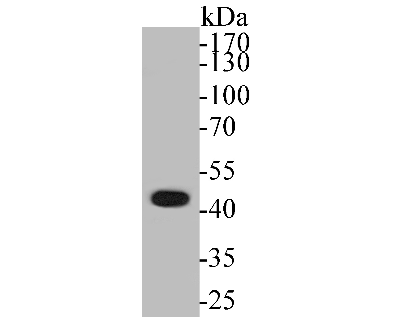 Western blot analysis of ABI2 on MCF-7 cell lysates. Proteins were transferred to a PVDF membrane and blocked with 5% BSA in PBS for 1 hour at room temperature. The primary antibody (ET7110-42, 1/500) was used in 5% BSA at room temperature for 2 hours. Goat Anti-Rabbit IgG - HRP Secondary Antibody (HA1001) at 1:5,000 dilution was used for 1 hour at room temperature.