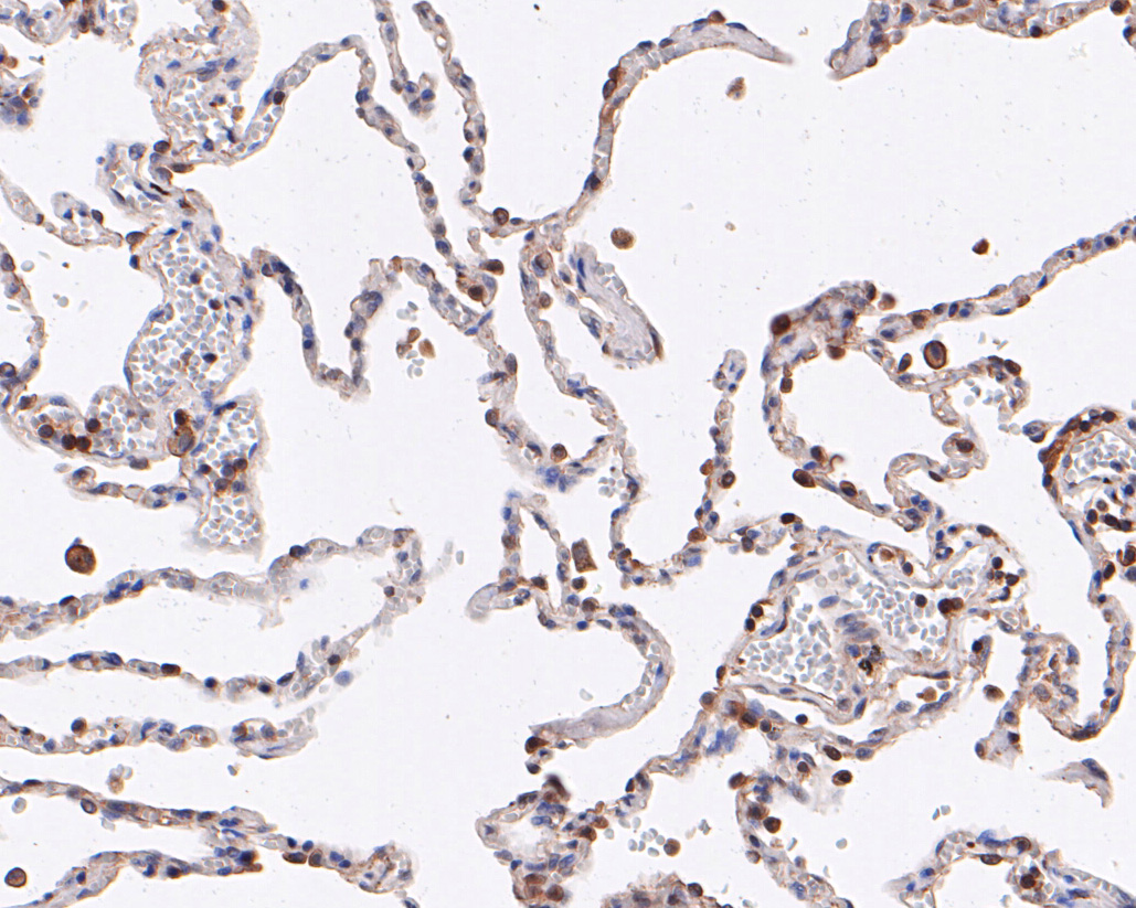 Immunohistochemical analysis of paraffin-embedded human lung tissue using anti-ABI2 antibody. The section was pre-treated using heat mediated antigen retrieval with sodium citrate buffer (pH 6.0) for 20 minutes. The tissues were blocked in 5% BSA for 30 minutes at room temperature, washed with ddH2O and PBS, and then probed with the primary antibody (ET7110-42, 1/50)  for 30 minutes at room temperature. The detection was performed using an HRP conjugated compact polymer system. DAB was used as the chromogen. Tissues were counterstained with hematoxylin and mounted with DPX.