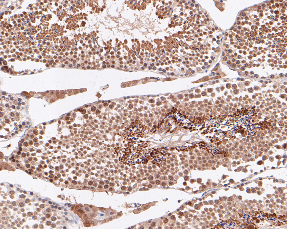 Immunohistochemical analysis of paraffin-embedded mouse testis tissue using anti-ABI2 antibody. The section was pre-treated using heat mediated antigen retrieval with sodium citrate buffer (pH 6.0) for 20 minutes. The tissues were blocked in 5% BSA for 30 minutes at room temperature, washed with ddH2O and PBS, and then probed with the primary antibody (ET7110-42, 1/50)  for 30 minutes at room temperature. The detection was performed using an HRP conjugated compact polymer system. DAB was used as the chromogen. Tissues were counterstained with hematoxylin and mounted with DPX.