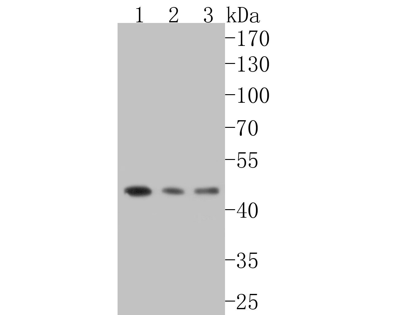 Western blot analysis of DP1 on different lysates. Proteins were transferred to a PVDF membrane and blocked with 5% BSA in PBS for 1 hour at room temperature. The primary antibody (ET7110-43, 1/500) was used in 5% BSA at room temperature for 2 hours. Goat Anti-Rabbit IgG - HRP Secondary Antibody (HA1001) at 1:200,000 dilution was used for 1 hour at room temperature.<br />
Positive control: <br />
Lane 1: SiHa cell lysate<br />
Lane 2: SH-SY5Y cell lysate<br />
Lane 3: Mouse thymus tissue lysate