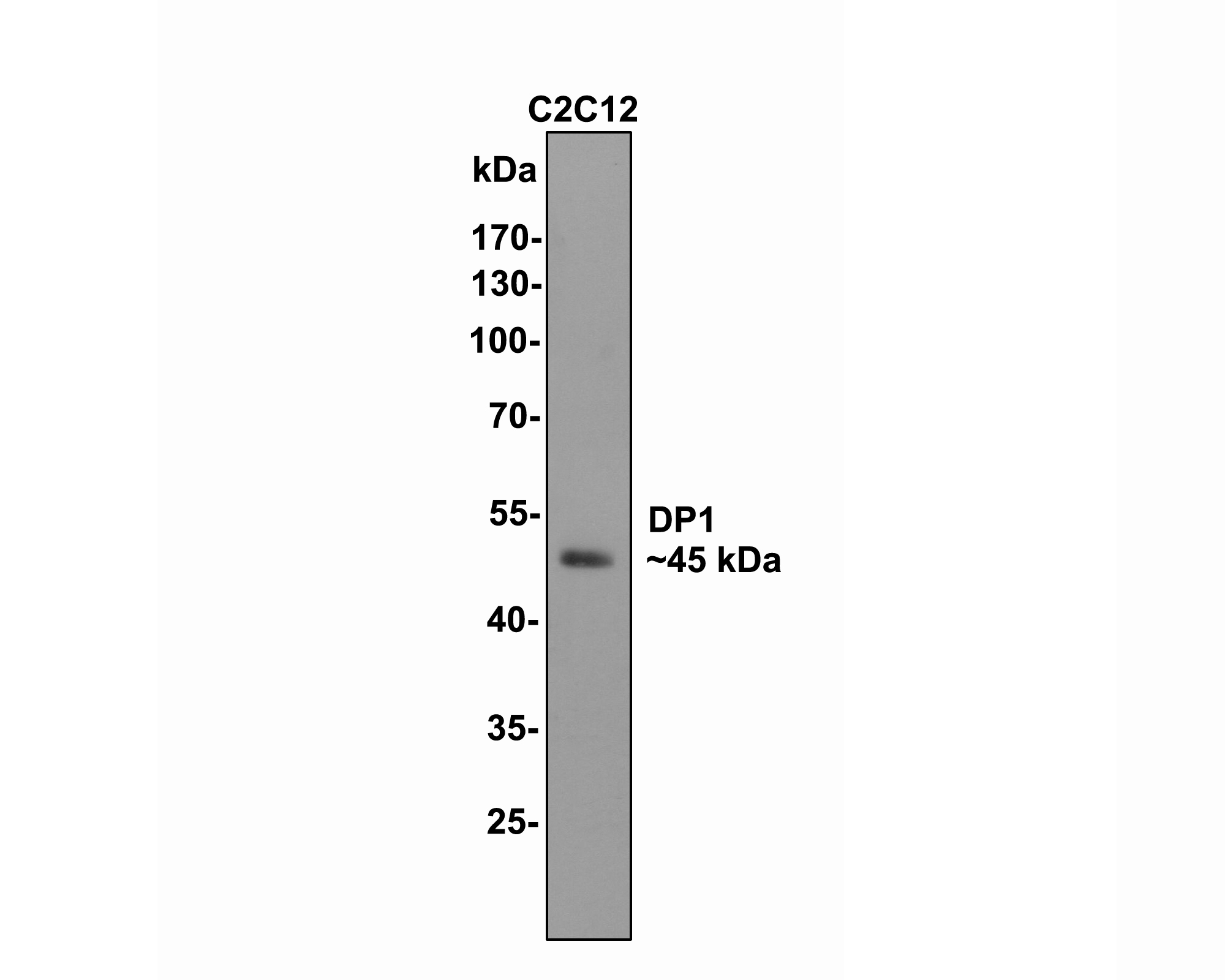 Western blot analysis of DP1 on C2C12 cell lysates with Rabbit anti-DP1 antibody (ET7110-43) at 1/500 dilution.<br />
<br />
Lysates/proteins at 10 µg/Lane.<br />
<br />
Predicted band size: 45 kDa<br />
Observed band size: 45 kDa<br />
<br />
Exposure time: 2 minutes;<br />
<br />
10% SDS-PAGE gel.<br />
<br />
Proteins were transferred to a PVDF membrane and blocked with 5% NFDM/TBST for 1 hour at room temperature. The primary antibody (ET7110-43) at 1/500 dilution was used in 5% NFDM/TBST at room temperature for 2 hours. Goat Anti-Rabbit IgG - HRP Secondary Antibody (HA1001) at 1:200,000 dilution was used for 1 hour at room temperature.