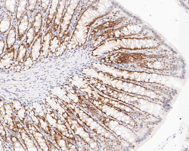 Immunohistochemical analysis of paraffin-embedded rat large intestine tissue using anti-DP1 antibody. The section was pre-treated using heat mediated antigen retrieval with sodium citrate buffer (pH 6.0) for 20 minutes. The tissues were blocked in 5% BSA for 30 minutes at room temperature, washed with ddH2O and PBS, and then probed with the primary antibody (ET7110-43, 1/200)  for 30 minutes at room temperature. The detection was performed using an HRP conjugated compact polymer system. DAB was used as the chromogen. Tissues were counterstained with hematoxylin and mounted with DPX.