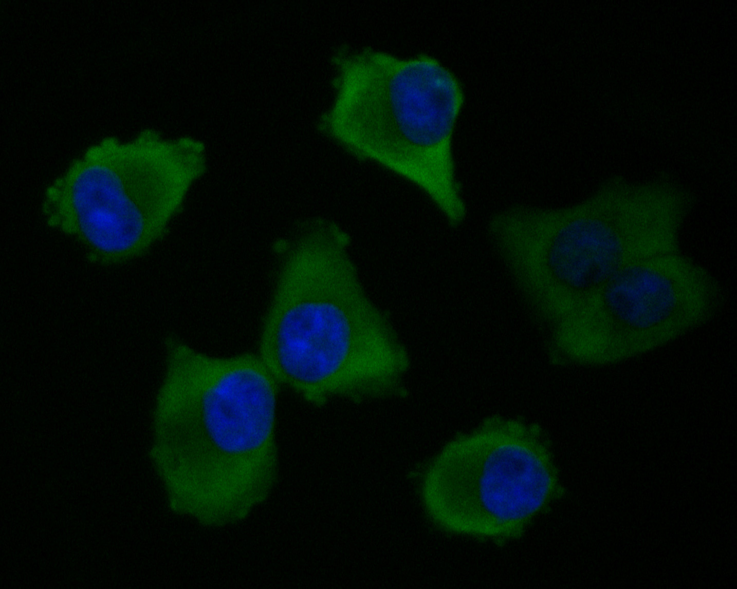 ICC staining of Elongation factor 1-gamma in PANC-1 cells (green). Formalin fixed cells were permeabilized with 0.1% Triton X-100 in TBS for 10 minutes at room temperature and blocked with 1% Blocker BSA for 15 minutes at room temperature. Cells were probed with the primary antibody (ET7110-45, 1/50) for 1 hour at room temperature, washed with PBS. Alexa Fluor®488 Goat anti-Rabbit IgG was used as the secondary antibody at 1/1,000 dilution. The nuclear counter stain is DAPI (blue).