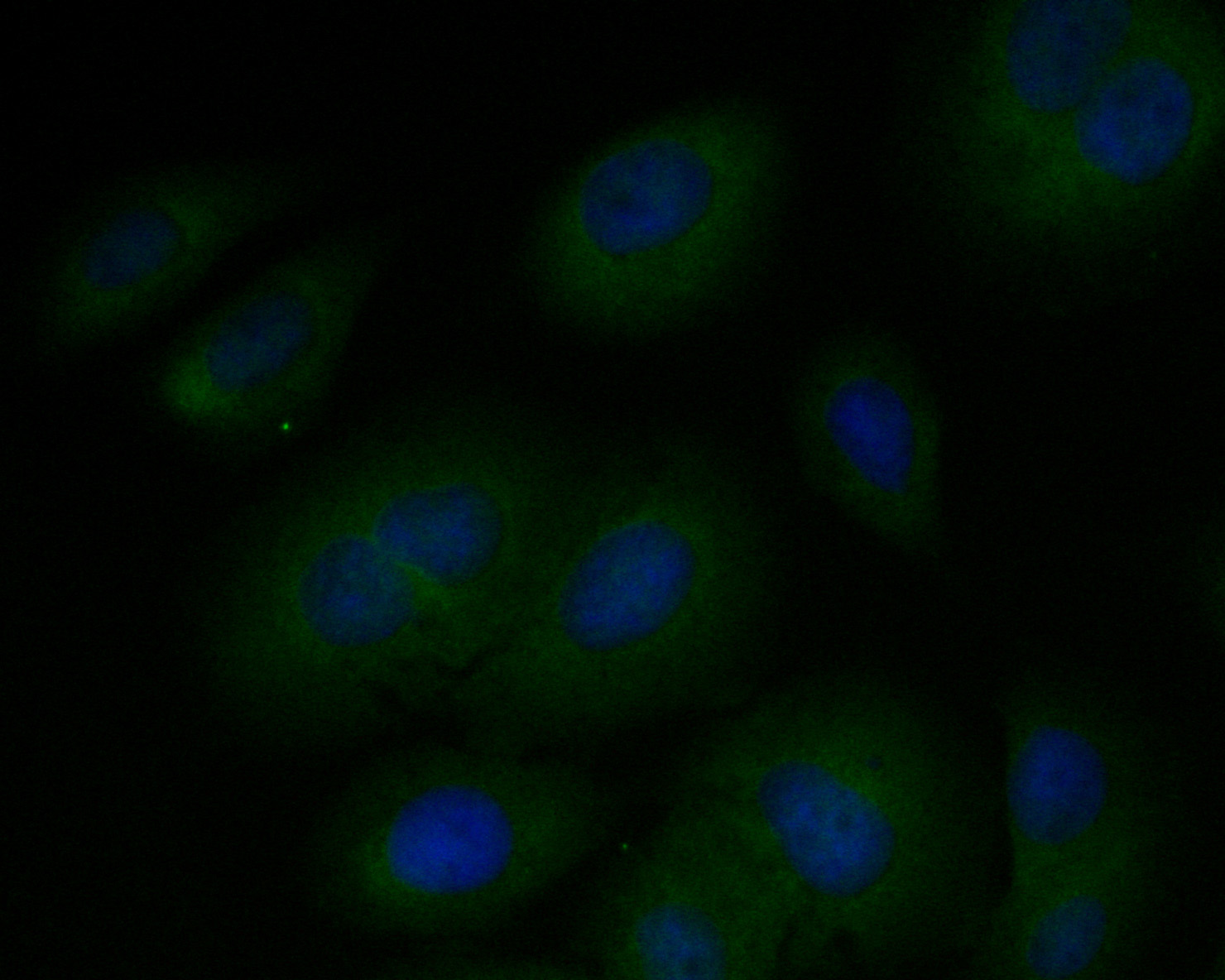ICC staining of Elongation factor 1-gamma in SKOV-3 cells (green). Formalin fixed cells were permeabilized with 0.1% Triton X-100 in TBS for 10 minutes at room temperature and blocked with 1% Blocker BSA for 15 minutes at room temperature. Cells were probed with the primary antibody (ET7110-45, 1/50) for 1 hour at room temperature, washed with PBS. Alexa Fluor®488 Goat anti-Rabbit IgG was used as the secondary antibody at 1/1,000 dilution. The nuclear counter stain is DAPI (blue).