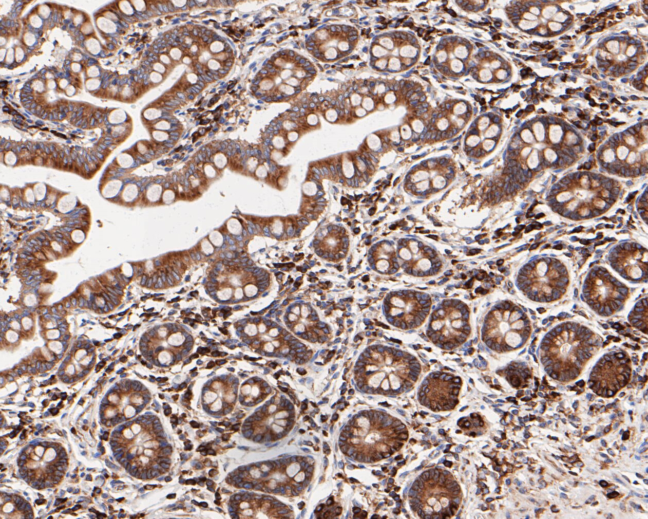 Immunohistochemical analysis of paraffin-embedded human small intestine tissue using anti-Elongation factor 1-gamma antibody. The section was pre-treated using heat mediated antigen retrieval with sodium citrate buffer (pH 6.0) for 20 minutes. The tissues were blocked in 5% BSA for 30 minutes at room temperature, washed with ddH2O and PBS, and then probed with the primary antibody (ET7110-45, 1/400)  for 30 minutes at room temperature. The detection was performed using an HRP conjugated compact polymer system. DAB was used as the chromogen. Tissues were counterstained with hematoxylin and mounted with DPX.