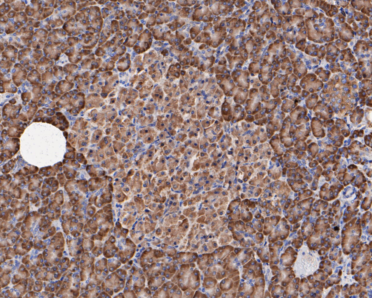 Immunohistochemical analysis of paraffin-embedded human pancreas tissue using anti-Elongation factor 1-gamma antibody. The section was pre-treated using heat mediated antigen retrieval with sodium citrate buffer (pH 6.0) for 20 minutes. The tissues were blocked in 5% BSA for 30 minutes at room temperature, washed with ddH2O and PBS, and then probed with the primary antibody (ET7110-45, 1/400)  for 30 minutes at room temperature. The detection was performed using an HRP conjugated compact polymer system. DAB was used as the chromogen. Tissues were counterstained with hematoxylin and mounted with DPX.